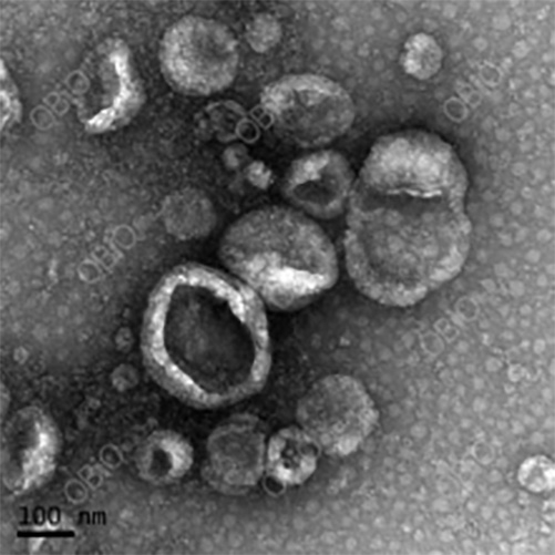  外泌体透射电镜图