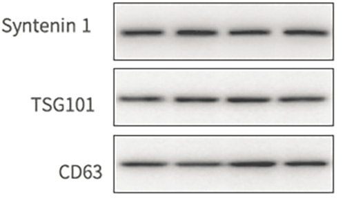 外泌体Western Blot图（Tian Su et al., ACS Nano. 2019）